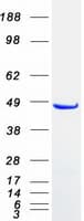 Human SNX5 Protein (Recombinant Myc-DDK (Flag))