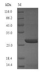 Influenza A Virus Hemagglutinin Protein (Recombinant 6His, N-terminus)