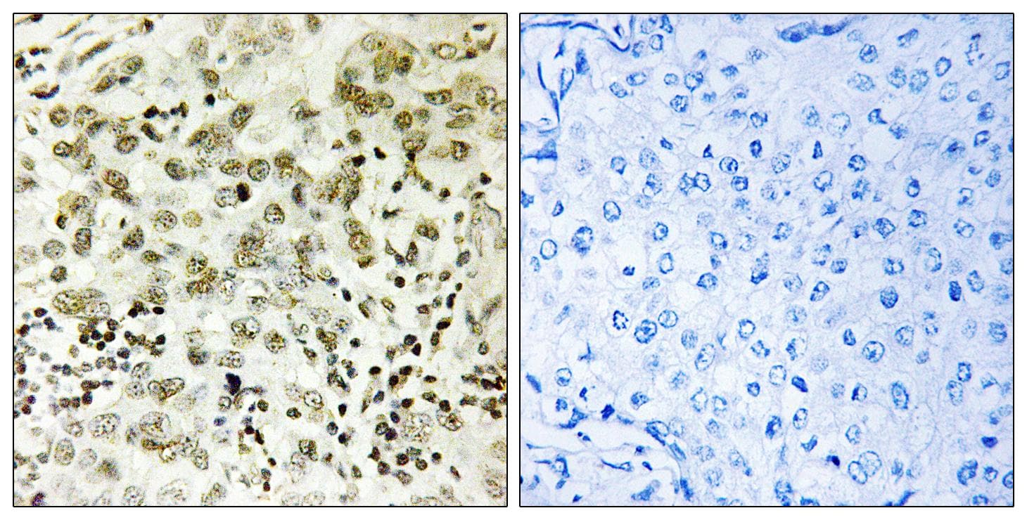 Polyclonal Rabbit anti-Human CTDSP1 / SCP1 Antibody (IHC, WB)