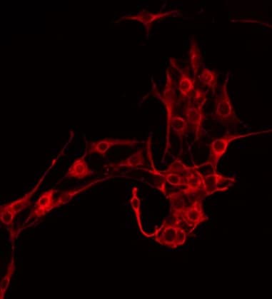 TSPO / PBR Antibody