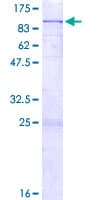 Human CLPB Protein (Recombinant GST)