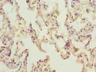 NINJ2 / Ninjurin 2 Antibody