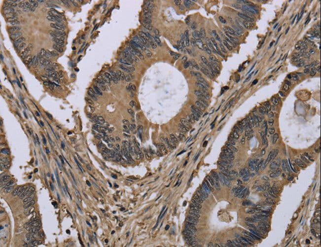 MYO18B / Myosin 18B Antibody