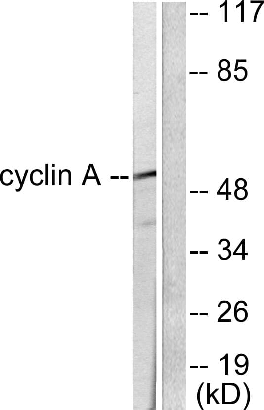 Cyclin A Antibody (Internal)