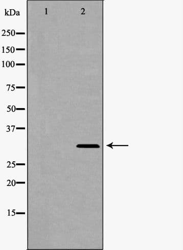 Polyclonal Rabbit anti-Human SDCBP / Syntenin Antibody (IHC, WB)