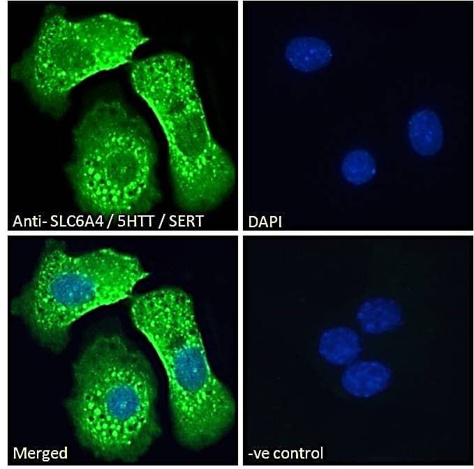 SLC6A4 / SERT Antibody (aa116-126)