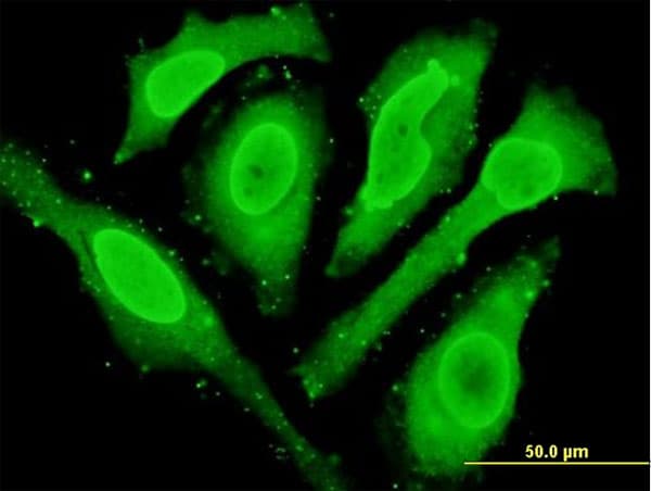 CYGB / Cytoglobin Antibody (clone 1A1)