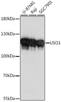 Polyclonal Rabbit anti-Human US01 / p115 Antibody (IF, WB)