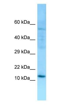 Polyclonal Rabbit anti-Human SERP1 Antibody (aa7-56, WB)