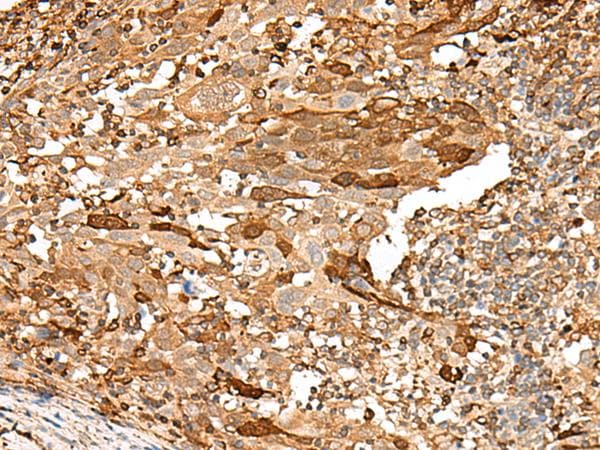 Polyclonal Rabbit anti-Human PIEZO2 / FAM38B Antibody (IHC)