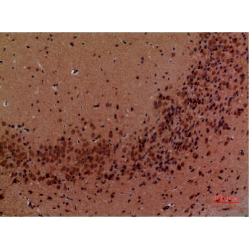 Polyclonal Rabbit anti-Human ABL2 Antibody (591-640 aa, Internal, IHC, WB)