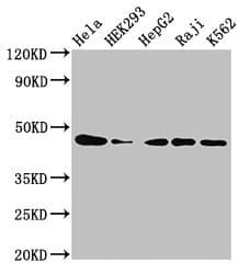 Polyclonal Rabbit anti-Human CSNK2A1 Antibody (aa1-391)