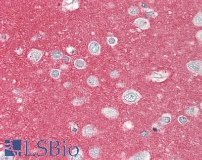 PathPlus™ NCAM / CD56 Antibody (aa20-718, clone 1G4)