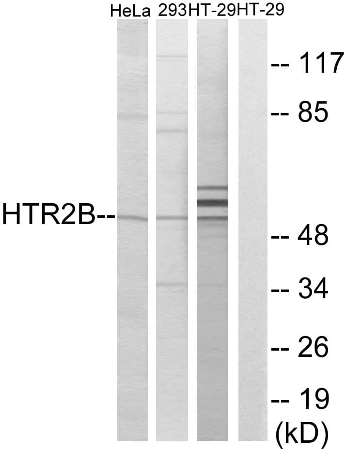 IHC-plus™ HTR2B / 5-HT2B Receptor Antibody (aa15-64)
