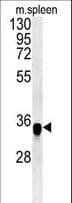 FAM49A Antibody (aa5-33)