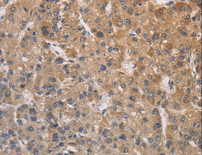 Polyclonal Rabbit anti-Human DSTN / Destrin Antibody (IHC)