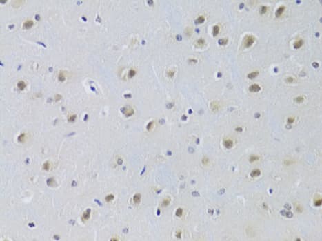 Polyclonal Rabbit anti-Human CDKN1B / p27 Kip1 Antibody (IHC, IF, WB)