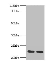Polyclonal Rabbit anti-Human RERG Antibody (aa1-199, IHC, WB)