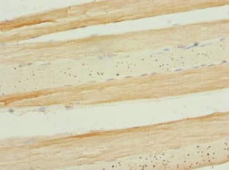 Polyclonal Rabbit anti-Human APIP Antibody (IHC, WB)