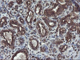 GCP60 / ACBD3 Antibody (clone OTI1G2)