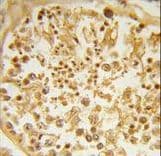 Polyclonal Rabbit anti-Human DZIP1 Antibody (aa568-596, IHC, WB)