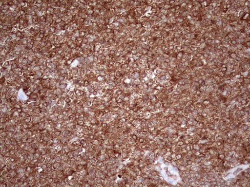 URP2 / FERMT3 Antibody (aa259-528, clone OTI2G2)