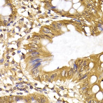 IRF6 Antibody