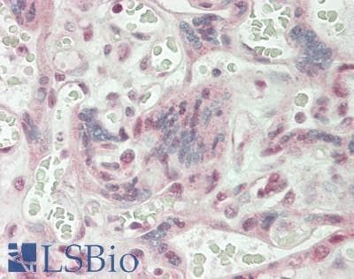 IHC-plus™ CD32C Antibody (C-Terminus)