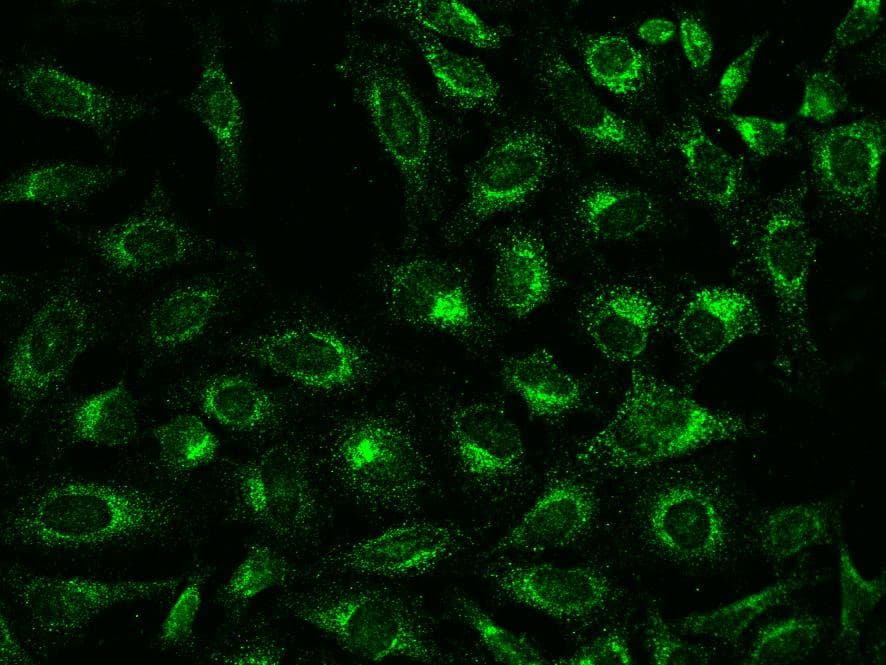 Polyclonal Rabbit anti-Human Rho Kinase / ROCK1 Antibody (IF)
