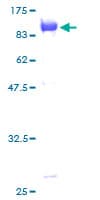 Human UBQLN1 / Ubiquilin Protein (Recombinant GST)