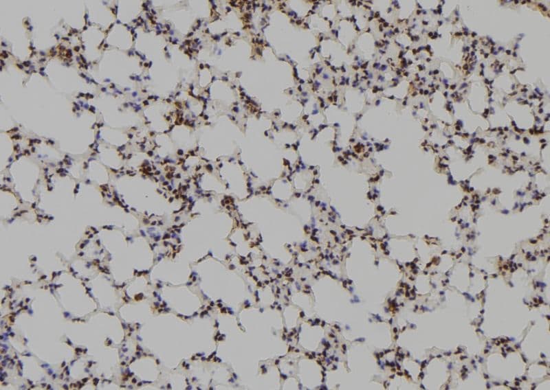 SYN / FYN Antibody