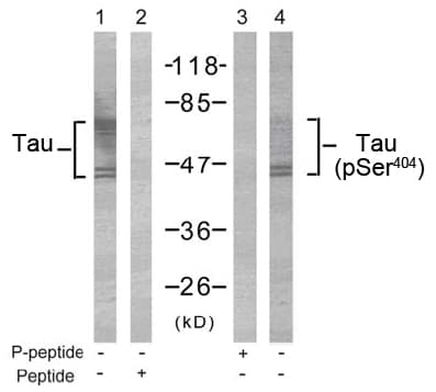 IHC-plus™ MAPT / Tau Antibody (Ser404)