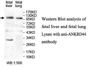 IHC-plus™ Polyclonal Rabbit anti-Human ANKRD44 Antibody (aa37-262, IHC, WB)