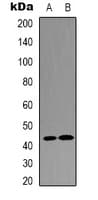 Polyclonal Rabbit anti-Human AP-1 / JUND Antibody (C-Terminus, IHC, WB)