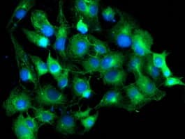 TUBAL3 Antibody (clone OTI1C2)