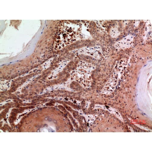RFC1 / RFC Antibody (1071-1120 aa, C-terminal)