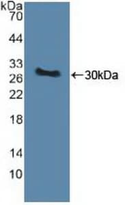 PINK1 Antibody (aa262-507, FITC)