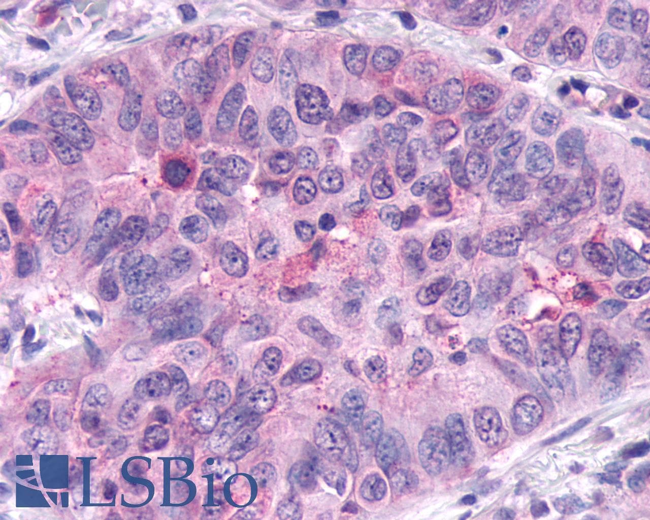 PathPlus™ FZD5 / Frizzled 5 Antibody (N-Terminus)