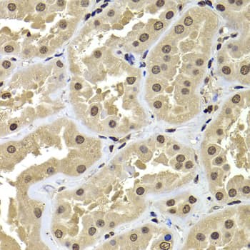 Polyclonal Rabbit anti-Human BAF53B / ACTL6B Antibody (IHC, IF, WB)