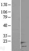 Human HCP5 Protein (Over-Expression Lysate Myc-DDK (Flag))