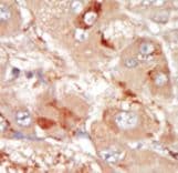 PRPF4B Antibody (aa948-978)