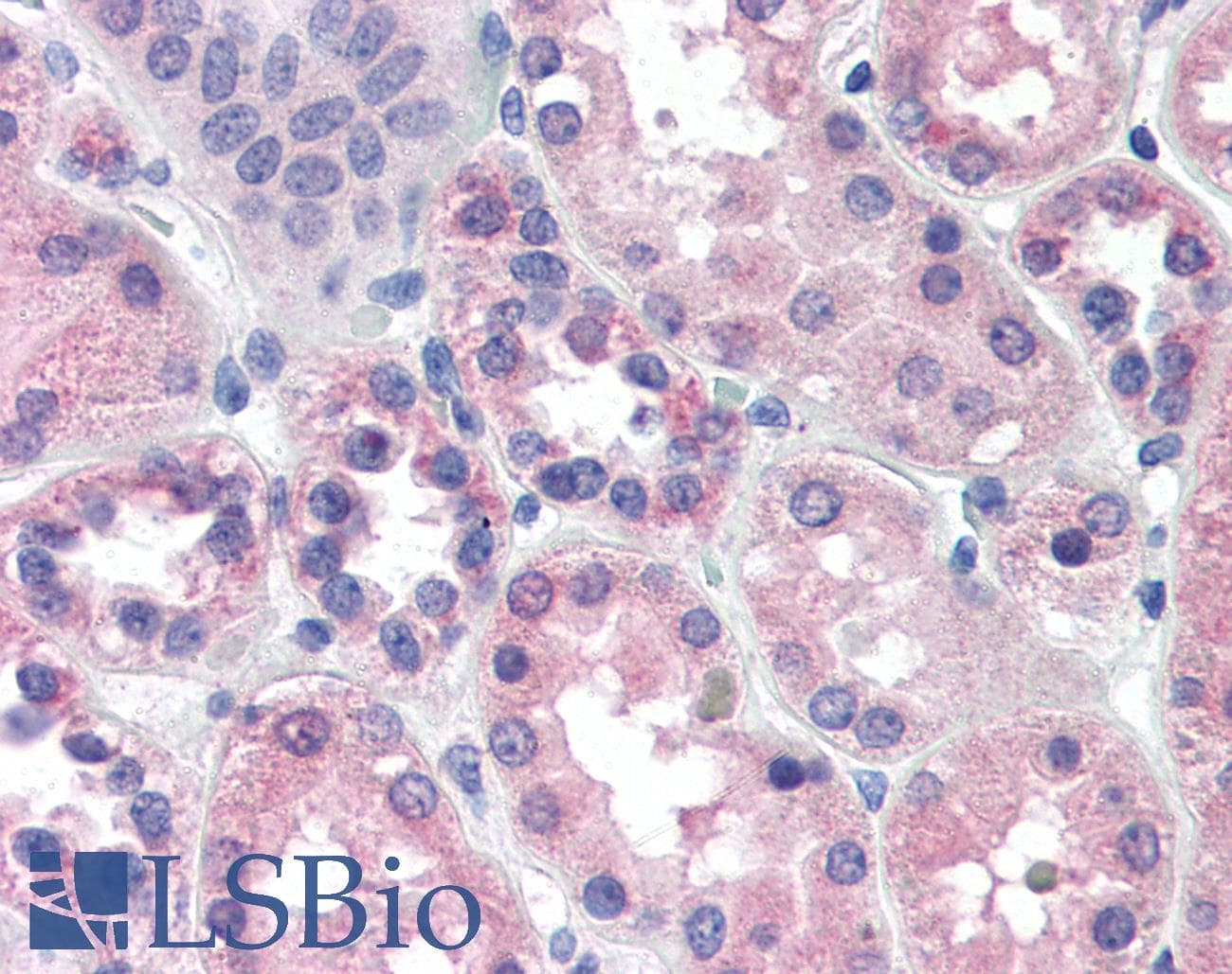 IHC-plus™ Polyclonal Goat anti-Human PCK1 Antibody (aa513-524, IHC)