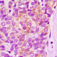 LYN Antibody (C-Terminus)