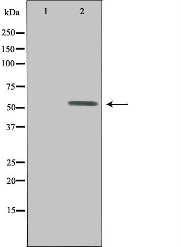 UEVLD Antibody