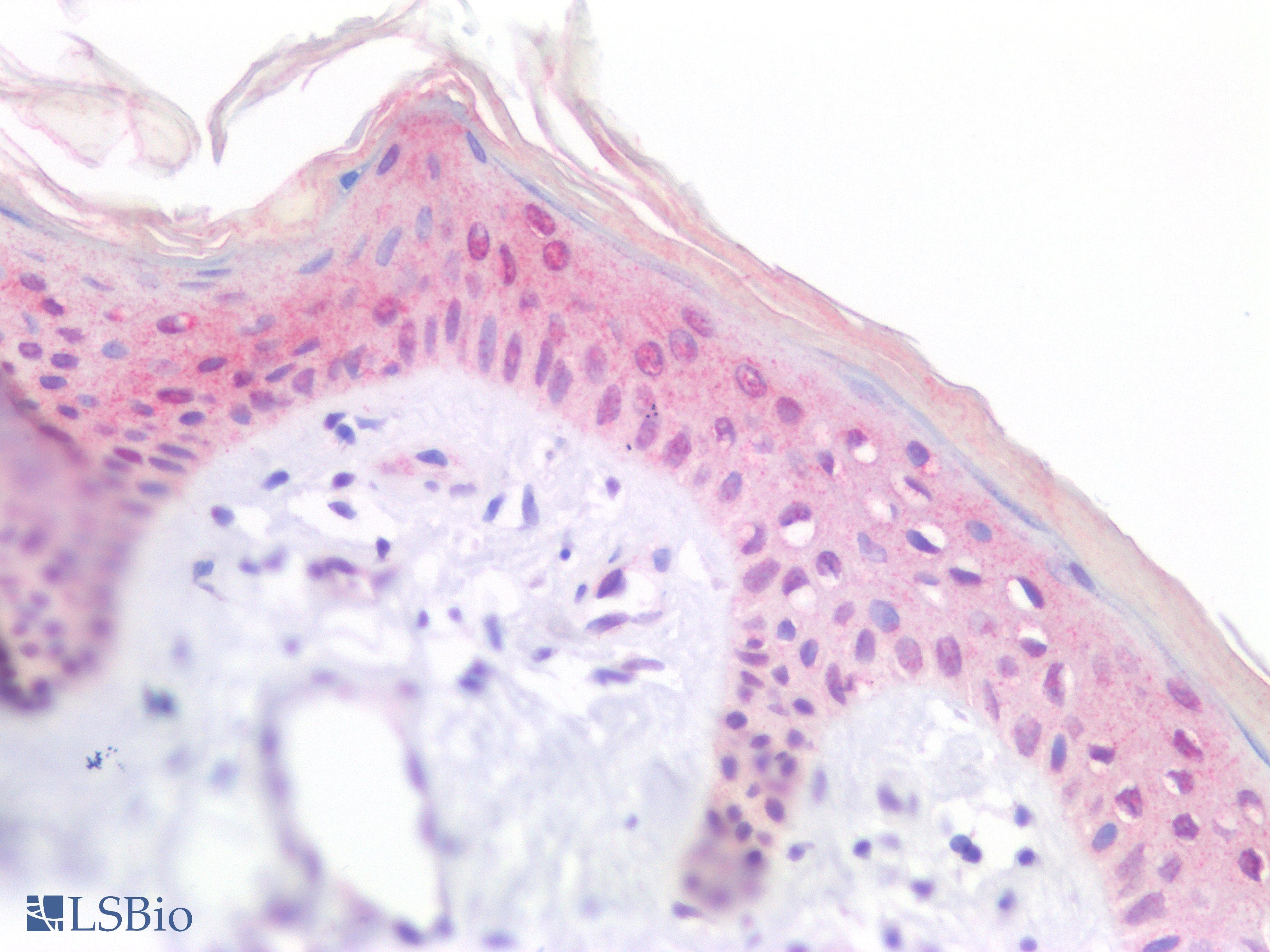 IHC-plus™ CCND1 / Cyclin D1 Antibody (clone 3B6G3)