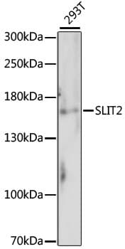Polyclonal Rabbit anti-Human SLIT2 Antibody (WB)