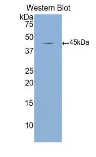MBL2 / Mannose Binding Protein Antibody (aa130-248)