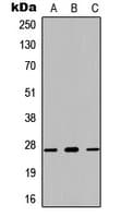 KLK7 / Kallikrein 7 Antibody (N-Terminus)
