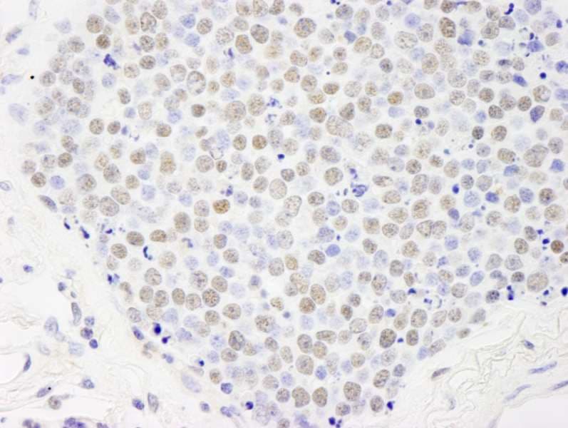 Polyclonal Rabbit anti-Human PD2 / PAF1 Antibody (aa475-525, IHC)