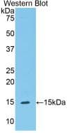 SERPING1 / C1 Inhibitor Antibody (aa211-331)